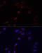 Adrenoceptor Alpha 1B antibody, 23-243, ProSci, Immunofluorescence image 