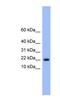 Nuclear Transport Factor 2 Like Export Factor 1 antibody, NBP1-79561, Novus Biologicals, Western Blot image 