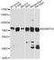 ADAM Metallopeptidase With Thrombospondin Type 1 Motif 4 antibody, STJ22510, St John