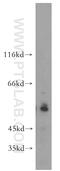Ubiquitin Specific Peptidase 3 antibody, 12490-1-AP, Proteintech Group, Western Blot image 