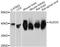 Aldolase, Fructose-Bisphosphate C antibody, A11618, ABclonal Technology, Western Blot image 