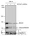 Rho Associated Coiled-Coil Containing Protein Kinase 1 antibody, GTX125921, GeneTex, Western Blot image 