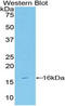 Vasoactive Intestinal Peptide antibody, LS-C296969, Lifespan Biosciences, Western Blot image 