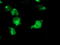 Interferon Regulatory Factor 6 antibody, TA503382, Origene, Immunofluorescence image 