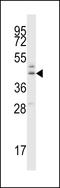 Beta-1,4-glucuronyltransferase 1 antibody, LS-C156710, Lifespan Biosciences, Western Blot image 