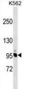 Non-SMC Condensin I Complex Subunit H antibody, abx030575, Abbexa, Western Blot image 