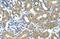 Alcohol Dehydrogenase 4 (Class II), Pi Polypeptide antibody, GTX16238, GeneTex, Immunohistochemistry paraffin image 