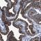 Coiled-Coil Domain Containing 146 antibody, HPA020082, Atlas Antibodies, Immunohistochemistry frozen image 