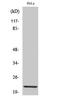 Claudin 1 antibody, STJ92307, St John