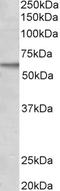 Activin A Receptor Like Type 1 antibody, LS-C54444, Lifespan Biosciences, Western Blot image 