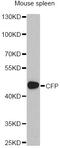 Complement Factor Properdin antibody, STJ27351, St John