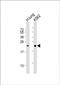 Surfactant Protein C antibody, PA5-71842, Invitrogen Antibodies, Western Blot image 