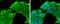 Rho Associated Coiled-Coil Containing Protein Kinase 2 antibody, GTX122652, GeneTex, Immunofluorescence image 