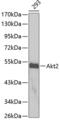 AKT Serine/Threonine Kinase 2 antibody, 14-464, ProSci, Western Blot image 