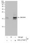 Survivin antibody, PA5-27087, Invitrogen Antibodies, Immunoprecipitation image 