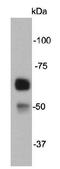Synuclein Gamma antibody, orb154214, Biorbyt, Western Blot image 