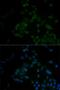 ADP Ribosylation Factor 6 antibody, LS-C332390, Lifespan Biosciences, Immunofluorescence image 