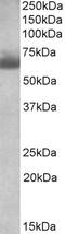 Achaete-Scute Family BHLH Transcription Factor 3 antibody, 42-720, ProSci, Enzyme Linked Immunosorbent Assay image 