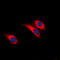 Insulin Receptor antibody, GTX55015, GeneTex, Immunocytochemistry image 