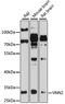 Vanin 2 antibody, 23-444, ProSci, Western Blot image 