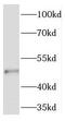 Ribitol Xylosyltransferase 1 antibody, FNab08783, FineTest, Western Blot image 