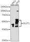 Solute Carrier Family 2 Member 1 antibody, GTX66489, GeneTex, Western Blot image 