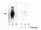 Interferon Alpha And Beta Receptor Subunit 1 antibody, P00306, Boster Biological Technology, Western Blot image 