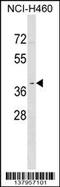 Olfactory Receptor Family 2 Subfamily Y Member 1 antibody, 59-469, ProSci, Western Blot image 