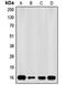 Cyclin-dependent kinase inhibitor 2A, isoforms 1/2/3 antibody, MBS821415, MyBioSource, Western Blot image 