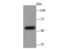 Cytochrome P450 Family 2 Subfamily D Member 6 antibody, A00498, Boster Biological Technology, Western Blot image 