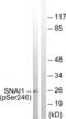 Snail Family Transcriptional Repressor 1 antibody, abx012522, Abbexa, Western Blot image 