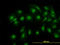 Cofilin 1 antibody, LS-C133114, Lifespan Biosciences, Immunofluorescence image 