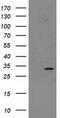 Nicotinamide N-Methyltransferase antibody, CF502538, Origene, Western Blot image 