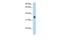 Solute Carrier Family 35 Member F2 antibody, GTX46812, GeneTex, Western Blot image 