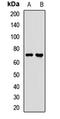 Lanosterol Synthase antibody, LS-C667884, Lifespan Biosciences, Western Blot image 