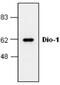 Death Inducer-Obliterator 1 antibody, GTX59722, GeneTex, Western Blot image 