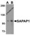 DLG Associated Protein 1 antibody, 4623, ProSci, Western Blot image 