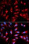 Dynamin 1 Like antibody, A00556-1, Boster Biological Technology, Western Blot image 