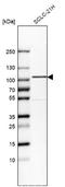 GIT ArfGAP 1 antibody, NBP1-85798, Novus Biologicals, Western Blot image 
