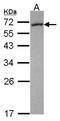 Flavin Containing Dimethylaniline Monoxygenase 5 antibody, PA5-30035, Invitrogen Antibodies, Western Blot image 