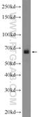 Amiloride-sensitive sodium channel subunit alpha antibody, 10924-2-AP, Proteintech Group, Western Blot image 