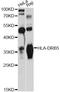 Major Histocompatibility Complex, Class II, DR Beta 5 antibody, LS-C747812, Lifespan Biosciences, Western Blot image 