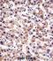 Oxidoreductase HTATIP2 antibody, abx028286, Abbexa, Immunohistochemistry frozen image 