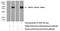 Serum/Glucocorticoid Regulated Kinase 2 antibody, 11185-1-AP, Proteintech Group, Western Blot image 