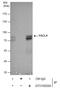 Acyl-CoA Synthetase Long Chain Family Member 4 antibody, GTX100260, GeneTex, Immunoprecipitation image 