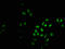 PHD Finger Protein 6 antibody, CSB-PA017917LA01HU, Cusabio, Immunofluorescence image 