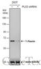 Plastin 3 antibody, GTX632481, GeneTex, Western Blot image 