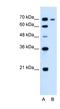Ribonucleotide Reductase Catalytic Subunit M1 antibody, NBP1-58187, Novus Biologicals, Western Blot image 