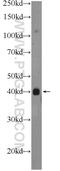 Polyhomeotic Homolog 2 antibody, 12867-1-AP, Proteintech Group, Western Blot image 
