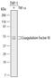 Coagulation Factor III, Tissue Factor antibody, MAB2339-100, R&D Systems, Western Blot image 